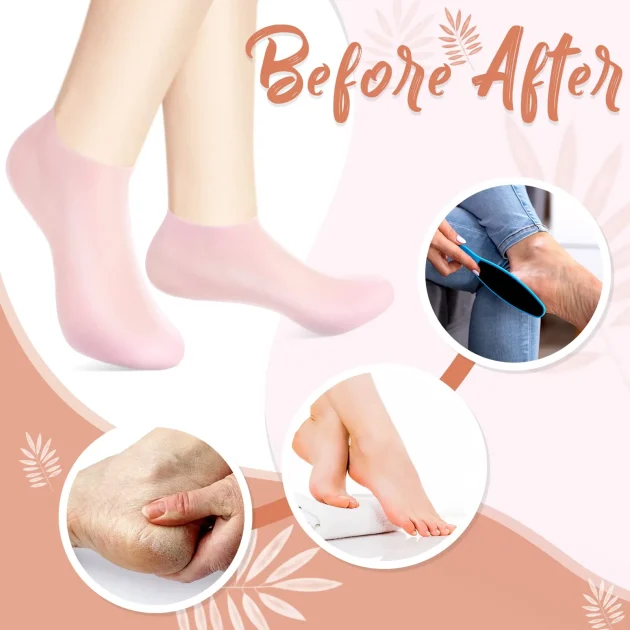 جوارب تشققات القدم الشفافة + الكريمة مجانا (T)